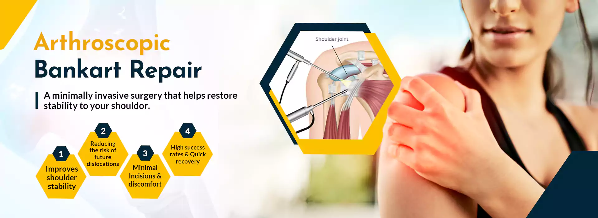 OSTEOLUXE BANNER 3 - arthroscopic bankart repair