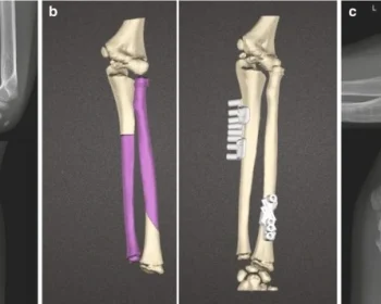 433395_1_En_87_Fig4_HTML