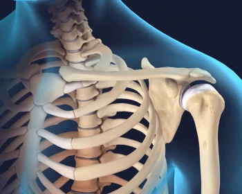 Reverse_Shoulder_Replacement