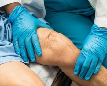 Total-Joint-Replacement-Surgery