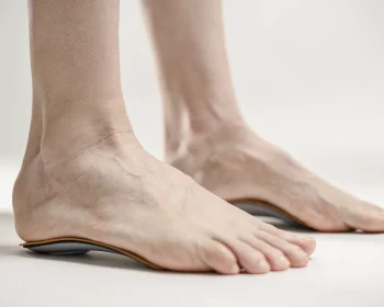 deformite-ortopediatri-1-scaled