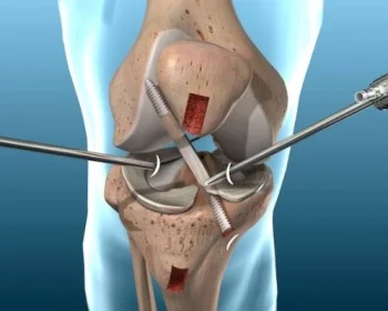 diz-artroskopisi-800x400-1