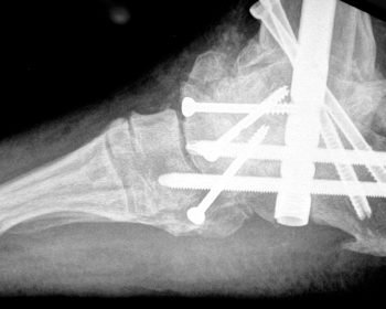 images_large_10.3113_fai.2011.0581-fig10