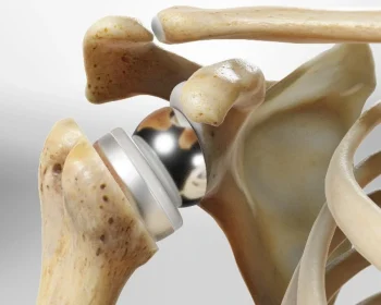 reversetotalsho_1280 (1)